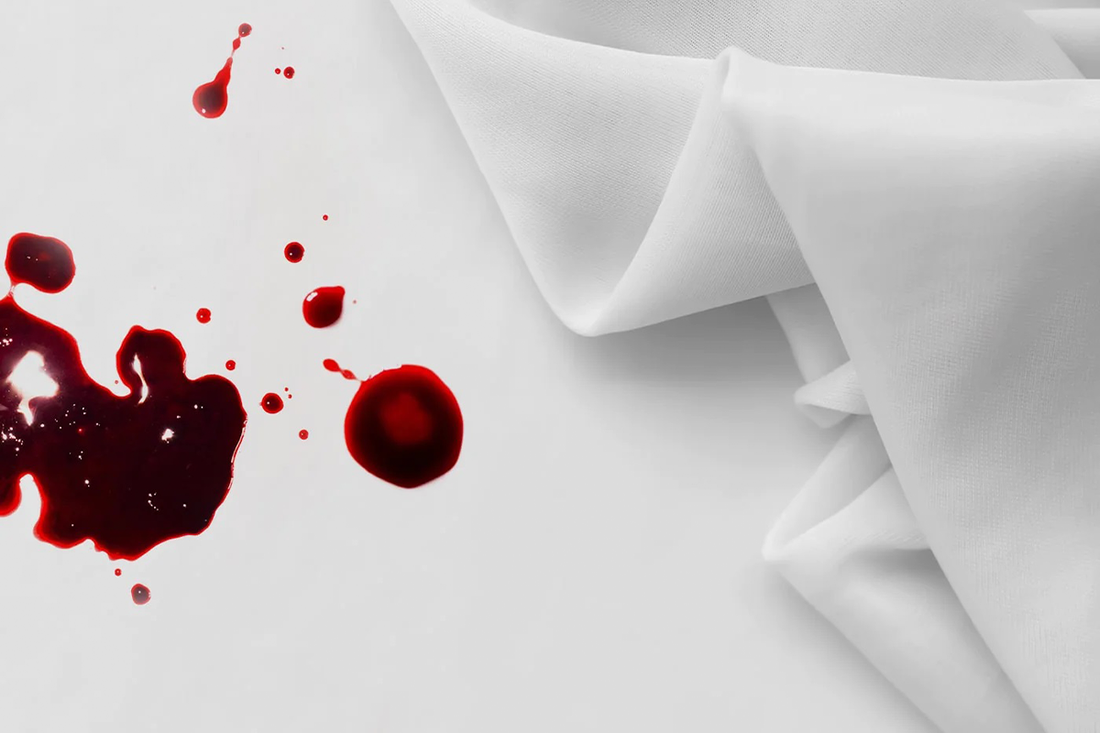 Three alterations in menstruation: hypermenorrhea, amenorrhea, and dysmenorrhea
