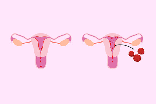 why-do-i-have-clots-during-my-menstruation